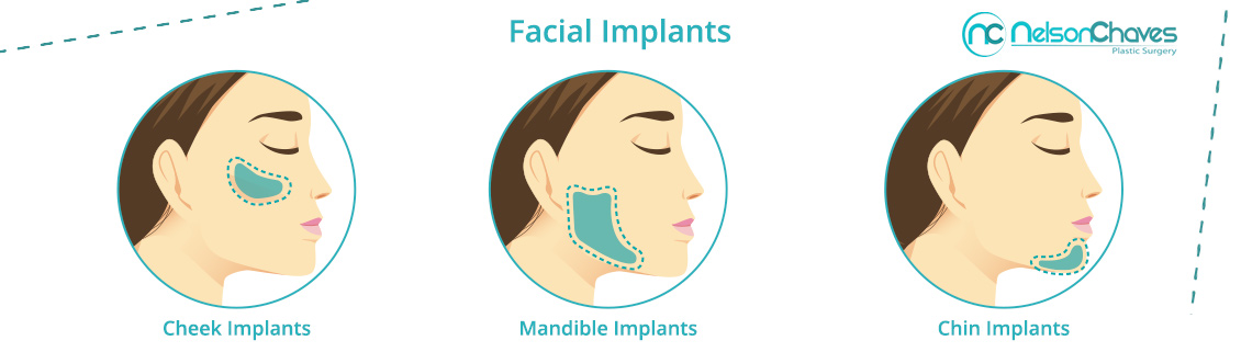 Facial Implants Types
