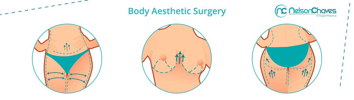 Correct Any Imperfection of your Body! Body Aesthetic Surgery