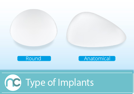 Type of Implants