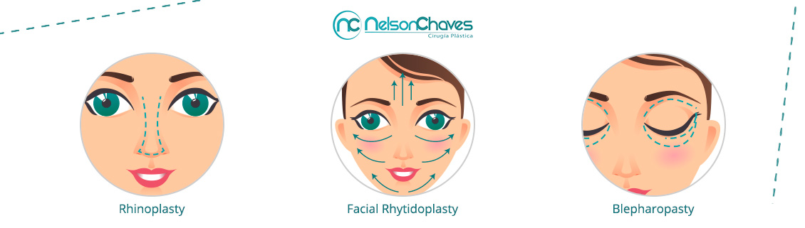 Facial Plastic Surgery