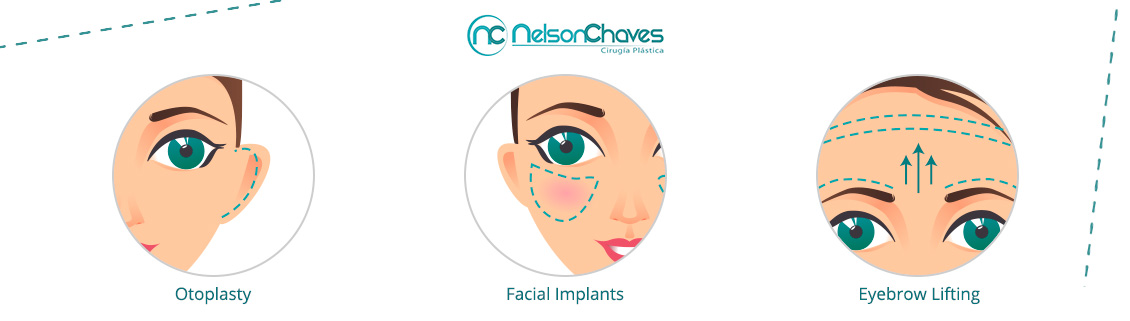 Facial Plastic Surgery Procedures